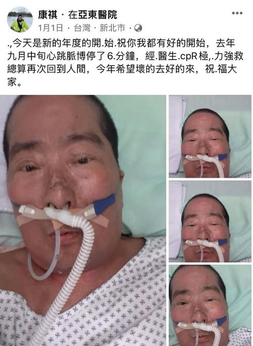 苟伟死因曝光 鼻息肉肥大致呼吸骤停
